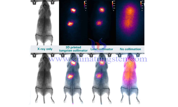 tungsten alloy in nuclear medicine image