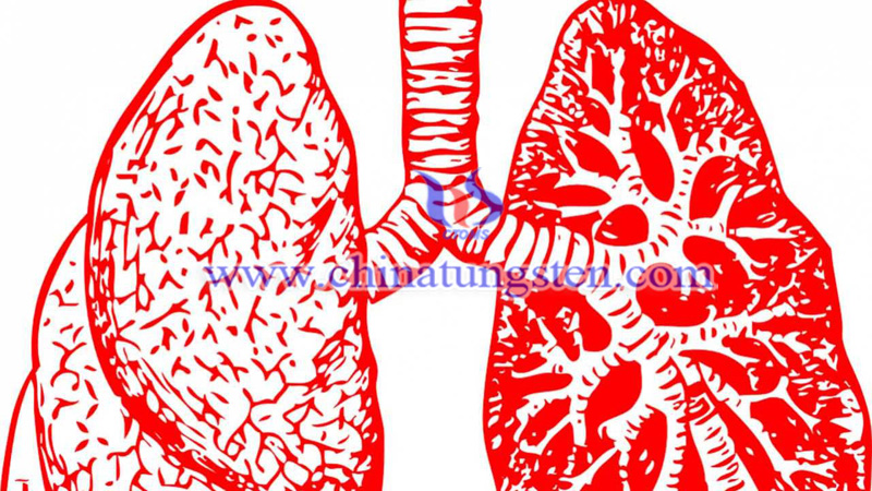 e-cigarette user may get tungsten and cobalt hard-metal lung disease image