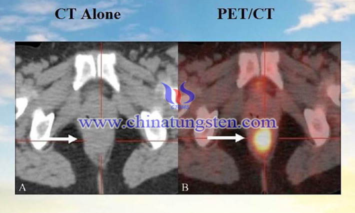 tungsten alloy collimator applied for PET-CT scanner picture